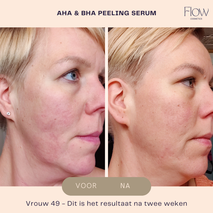 AHA & BHA Peeling Serum - Facial Peeling - Flow Cosmetics - 30ml