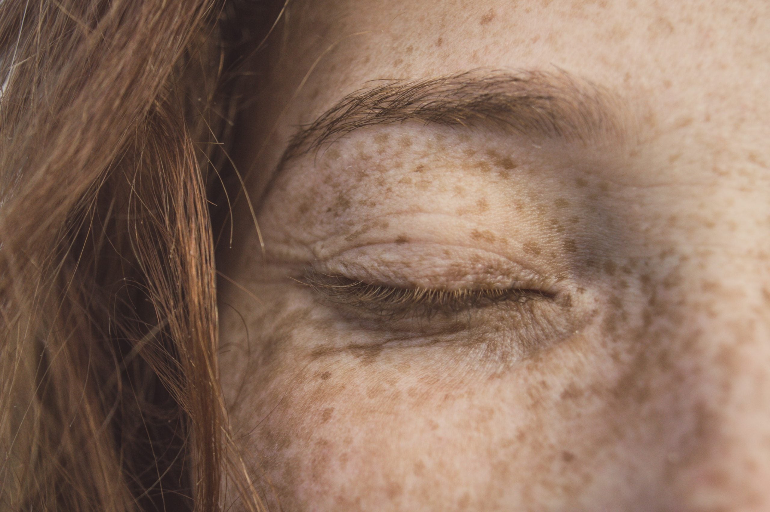 Pigmentvlekken verminderen met natuurlijke huidverzorging: ontdek onze beste tips & producten